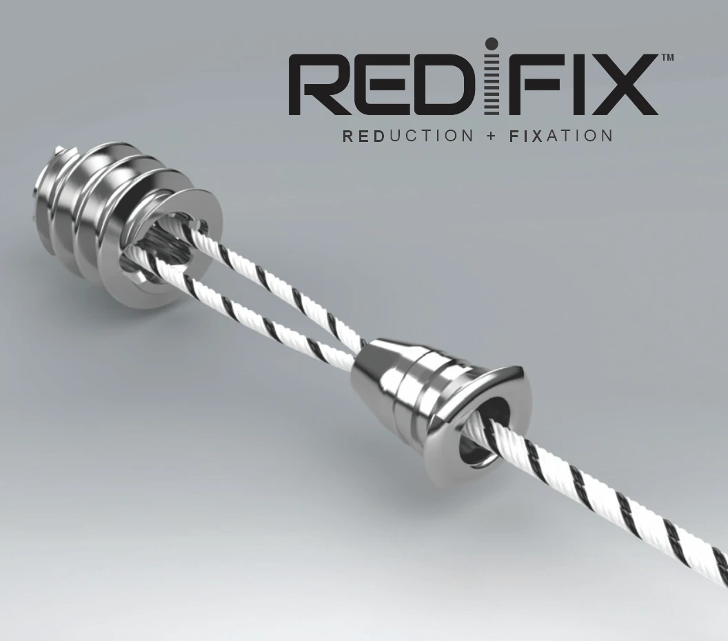 REDIFIX Orthopedic Fixation System