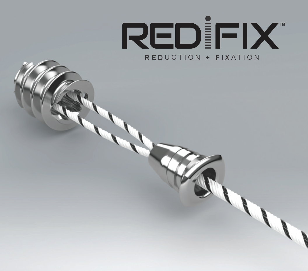 REDIFIX Suture Anchor System